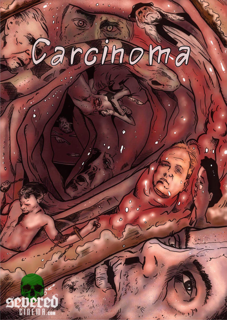 Artwork for Carcinoma by Martin Trafford