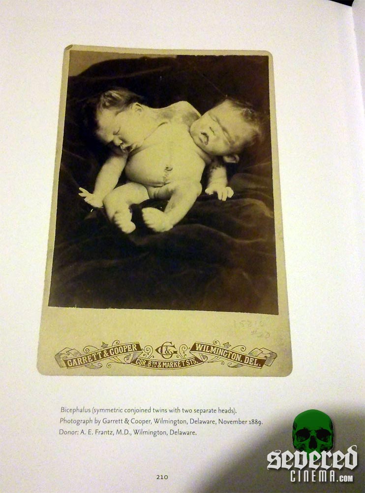 Mutter Museum: Historic Medical Photographs