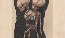 Review of Mutter Museum: Historical Medical Photographs!